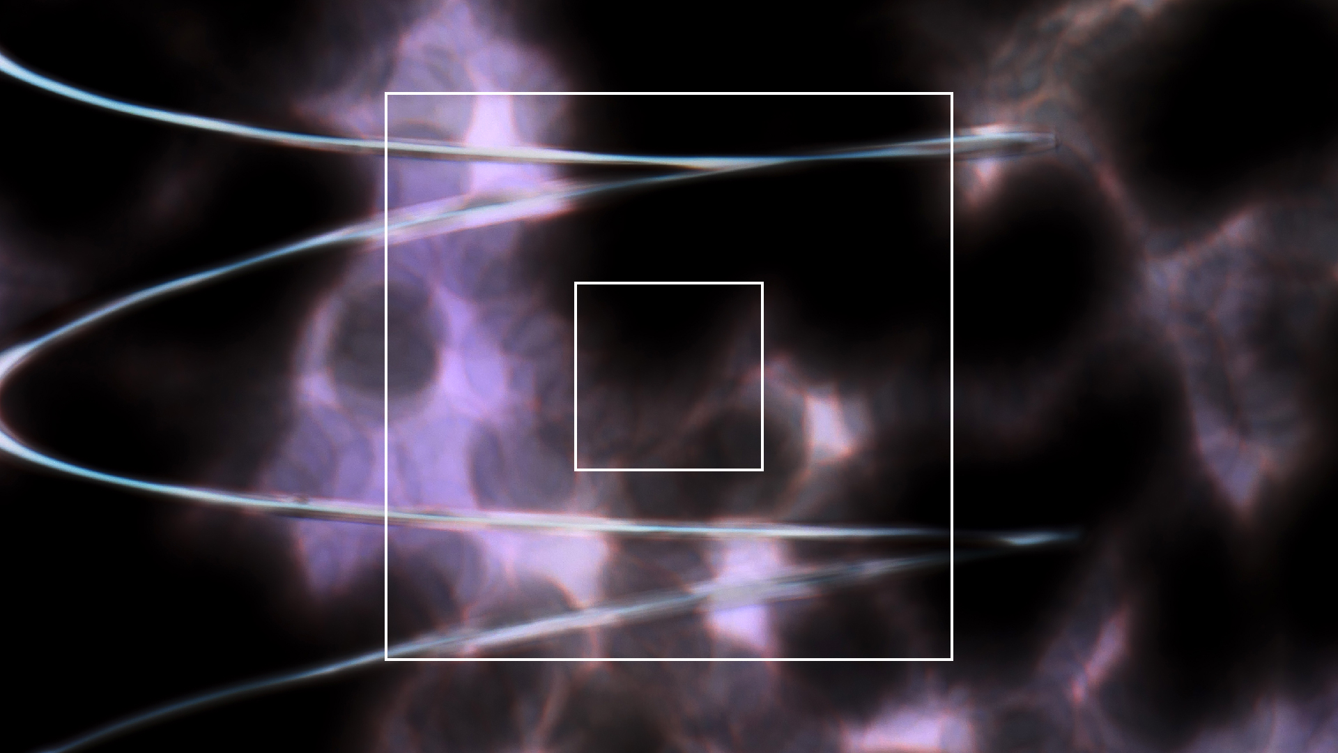 2022-08-27 Das Kleine Regen Rhythmus Orchester (Alublech, Federhall Errorcut) (Audio, Foto)